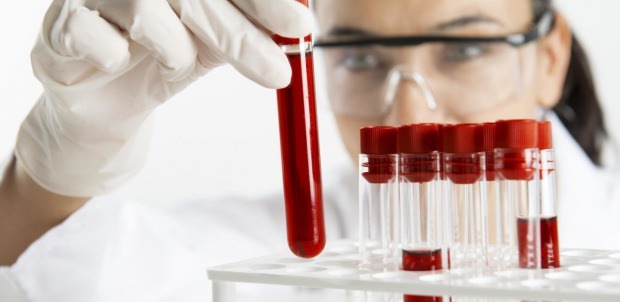 el nivel de hemoglabina se verifica mediante un análisis de sangre