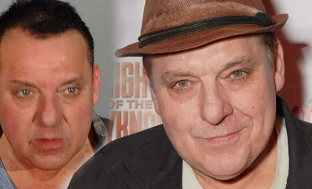 ¡Tom Sizemore murió de un aneurisma cerebral!