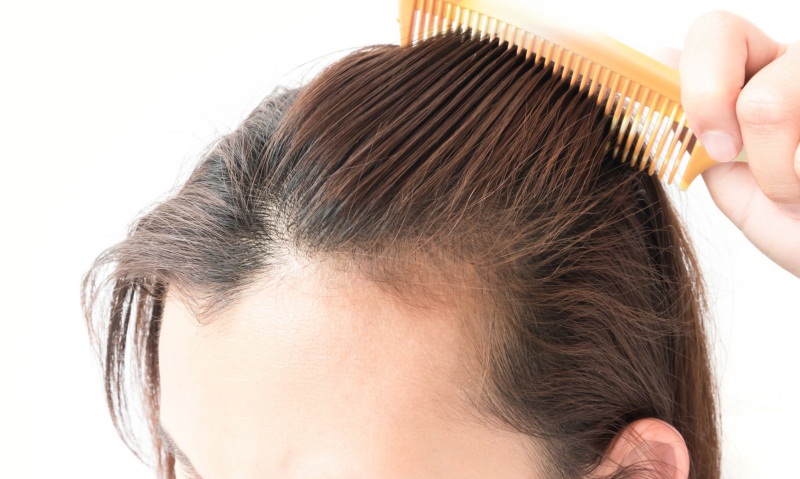 ¡Soluciones para la pérdida del cabello después del parto! ¿Qué es bueno para la caída del cabello?