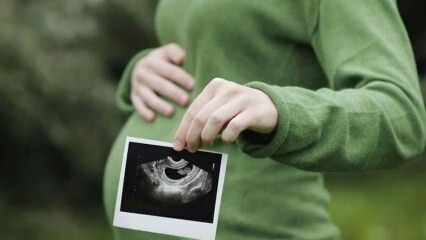 ¿Cuándo es el sexo del bebé lo más temprano y definitivo? ¿Quién determina el género?