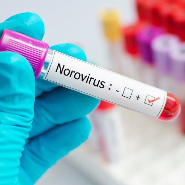 ¿Qué es el norovirus y qué enfermedades causa?
