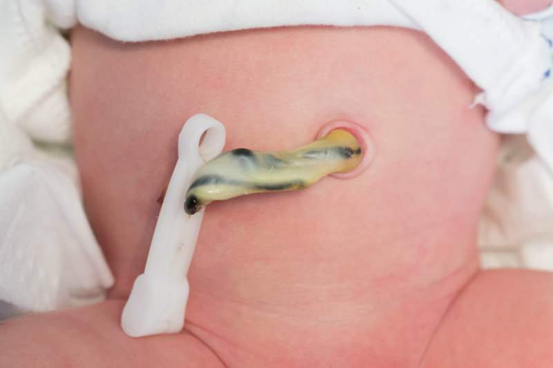 ¿Cuándo se cae el cordón umbilical en los bebés?