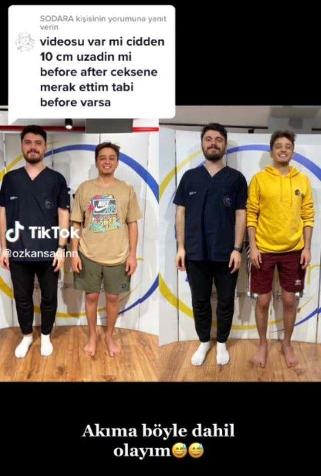 Özkan Sağın hizo antes y después de la cirugía