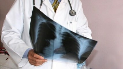 ¡Expertos anunciados! Aumento de las muertes por cáncer de pulmón.