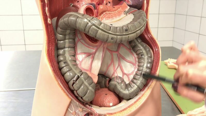 El sangrado anal puede ocurrir como resultado de una obstrucción en los intestinos.