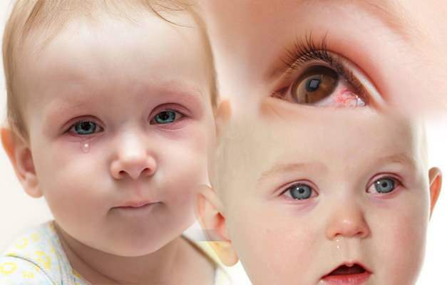 causa hemorragia ocular en los bebés