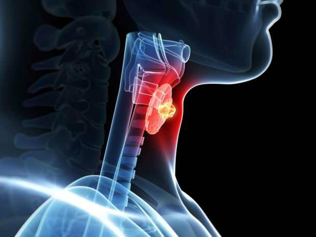Hashimato altera las glándulas tiroides