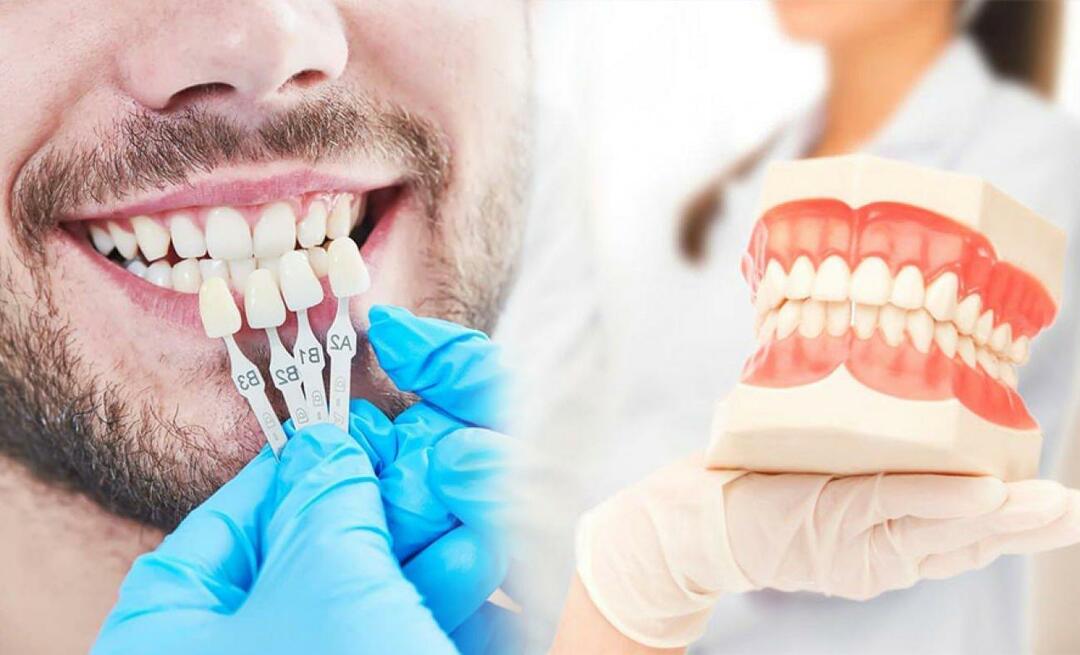 ¿Por qué se aplican coronas de zirconio a los dientes? ¿Qué tan duradero es el recubrimiento de zirconio?