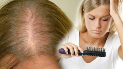¿Cuál es el método más eficaz contra la caída del cabello? Recetas de mascarillas que detienen la caída del cabello