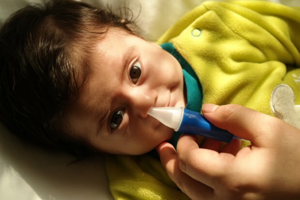 congestión nasal en infantes