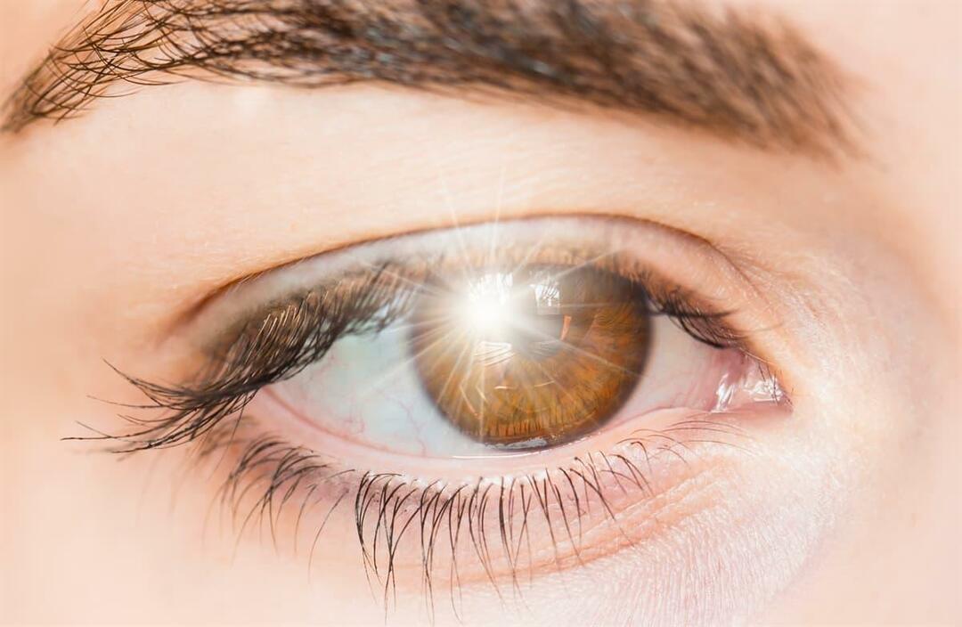 ¿Qué causa los destellos de luz en el ojo y cómo se trata?