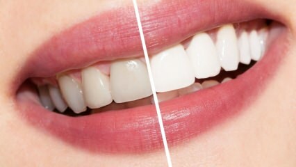 ¿Cuáles son las recomendaciones para los dientes blancos? Blanqueamiento dental cura naturalmente en casa ...