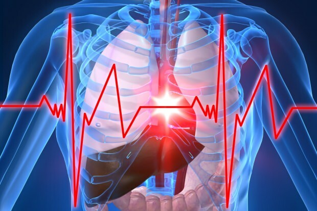 ¿Cuáles son los síntomas de un ataque al corazón?