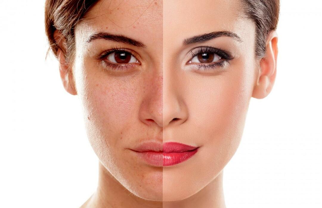 ¿Cómo evitamos que la piel luzca cansada? ¿Cómo reducir el aspecto cansado de la piel?