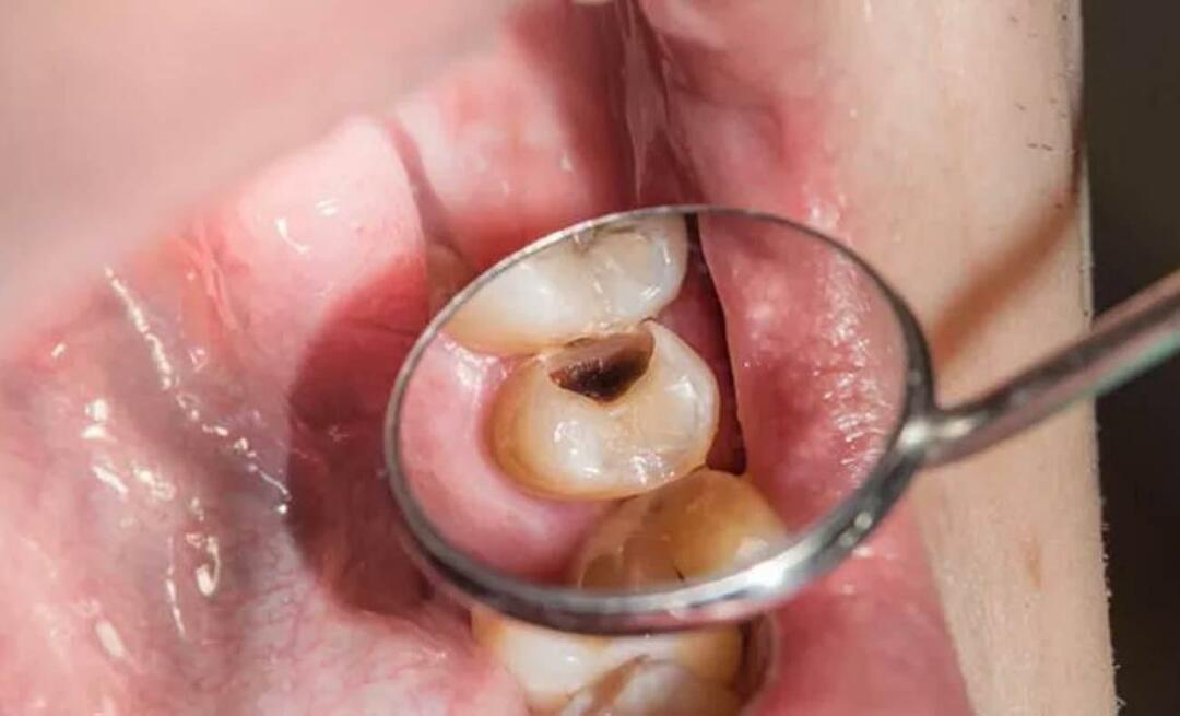 ¿Por qué se pudren los dientes y qué podemos hacer para evitarlo? 