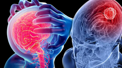 ¿Qué es la degeneración del cerebelo (médula espinal)? ¿Cuáles son los síntomas del cerebelo (médula espinal)?