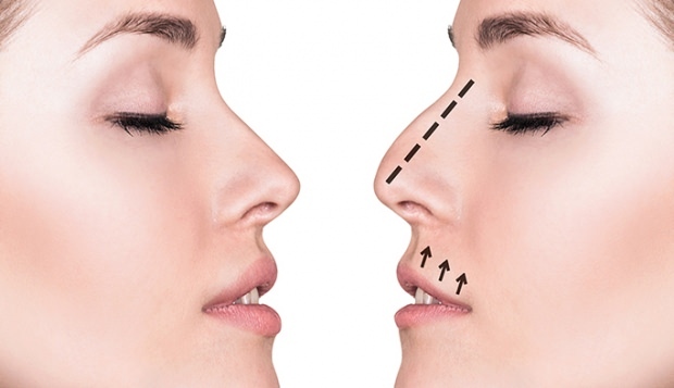 Cosas a tener en cuenta en la estética de la nariz