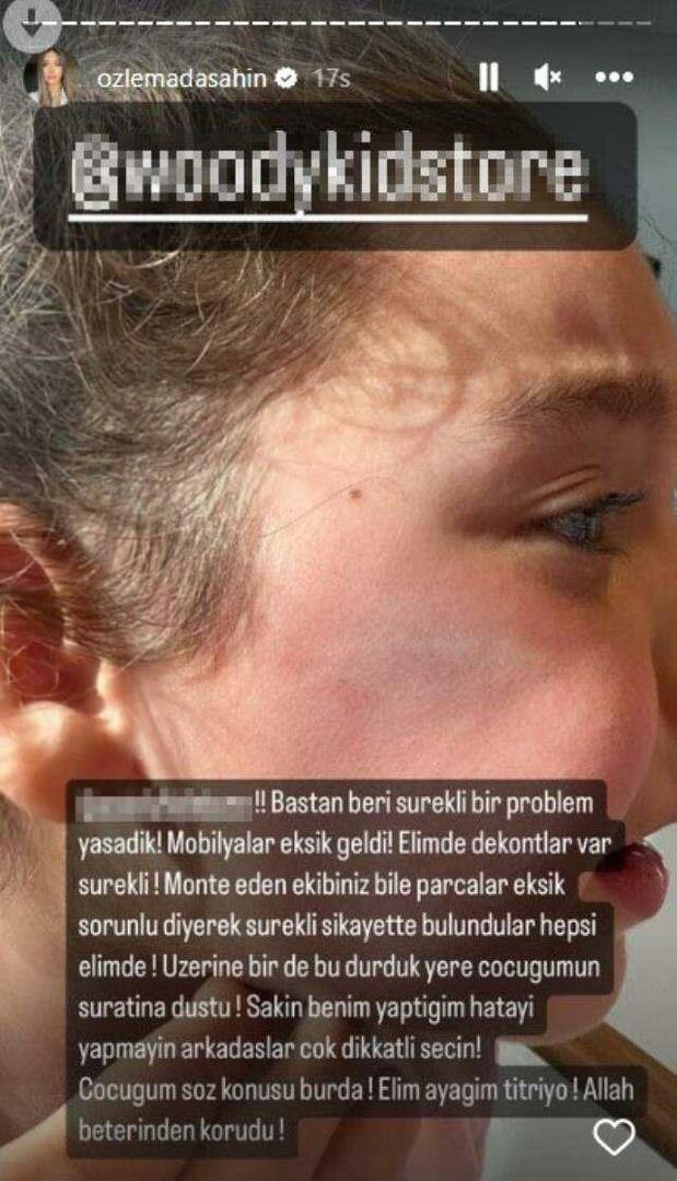 La puerta del armario cayó sobre la cara de la hija de Berkay Şahin
