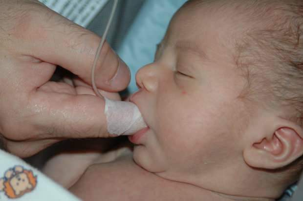¿Cuál es el método de alimentación con los dedos? ¿Cómo alimentar al bebé con una jeringa?