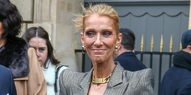 ¡Celine Dion molestó a sus amantes en la forma final! ¡Quedan piel y huesos!