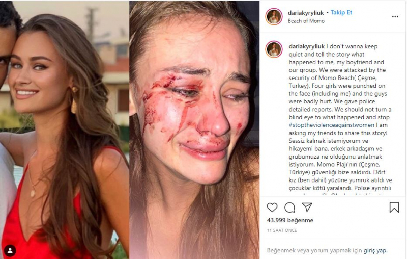 La top model ucraniana Daria Kyryliuk, supuestamente golpeada en İzmir Çeşme, habló por primera vez.