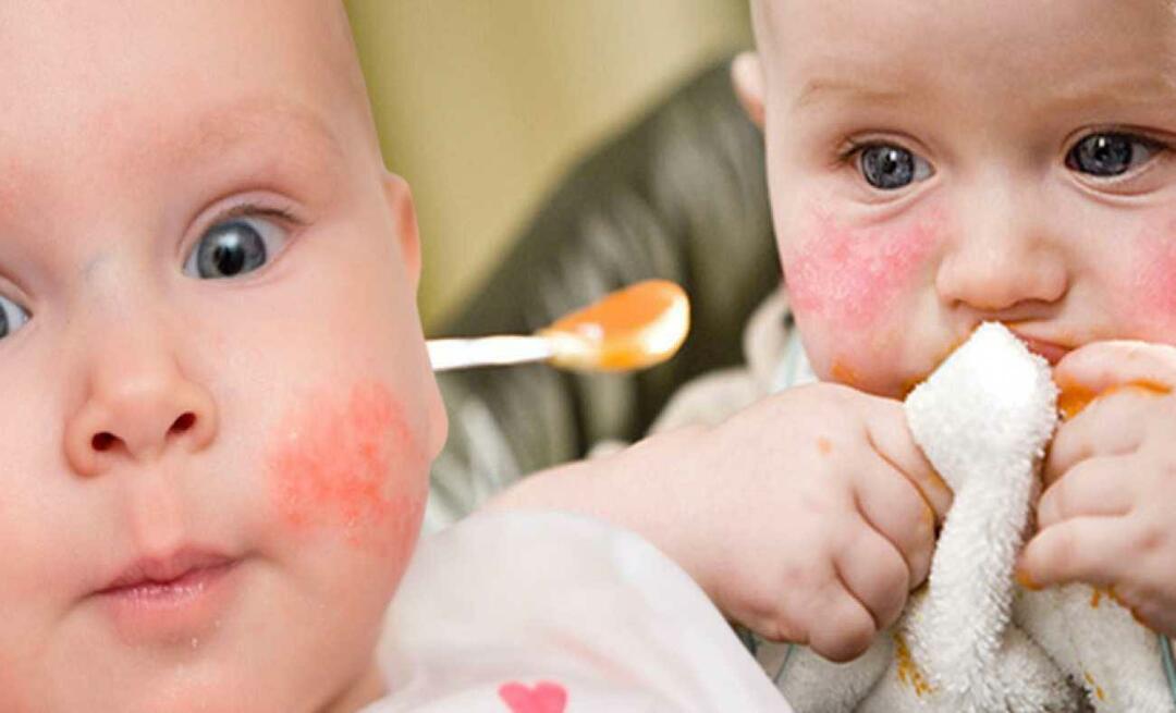 ¿Qué debe comer un bebé con alergias? ¿Cuáles son los alimentos alternativos para bebés alérgicos?