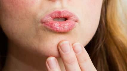 ¿Cómo cuidar los labios en casa? Cuidado de labios Easy Dry en 4 pasos