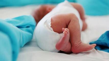 ¿Deben los bebés hacerse un ultrasonido de cadera?