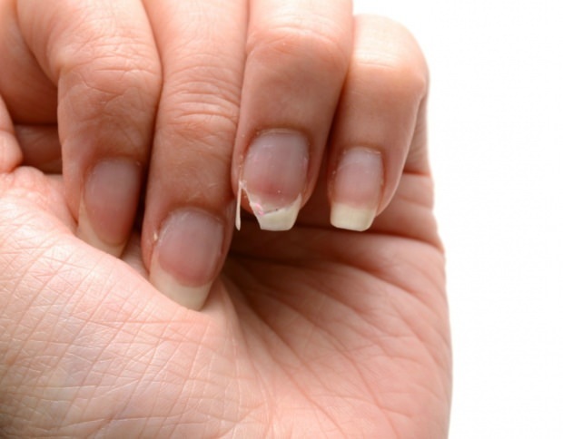 ¿Cómo se hace el cuidado de las uñas? Métodos rápidos de extensión de uñas