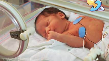 ¡La razón por la que los bebés son llevados a la incubadora! ¿Cuántos kilos de bebé se llevan en incubadora? Características de la incubadora para recién nacidos