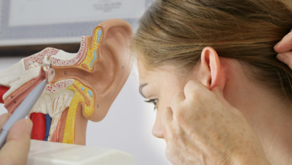 ¿Qué es la calcificación del oído (otosclerosis)? ¿Cuáles son los síntomas de la calcificación del oído (otosclerosis)?