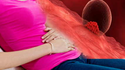 ¿Qué es el sangrado de implantación durante el embarazo? Cómo distinguir entre sangrado de implantación y sangrado menstrual
