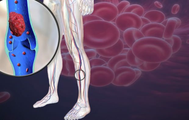 La disminución de la circulación sanguínea en las venas de las piernas causa dolor